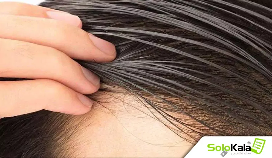 چرا پوست سرمون چرب میشه و چطوری درستش کنیم؟